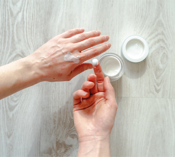 Man putting cream onto hand eczema 