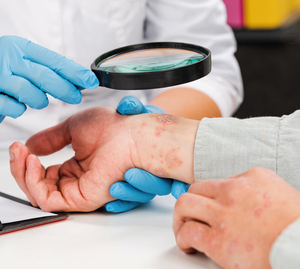 Dermatologist looking at eczema on patients wrist